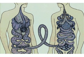 How and to Whom Should Fecal Transplantation be Applied? How and to Whom Should Fecal Transplantation be Applied?